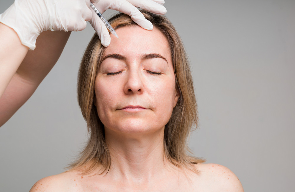 zornesfalte-loswerden-zuerich-schoenheitschirurgie